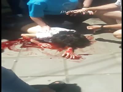 Woman / consequences of attack with machete