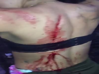 wtf.  Girl with Multiples Machete Slashes