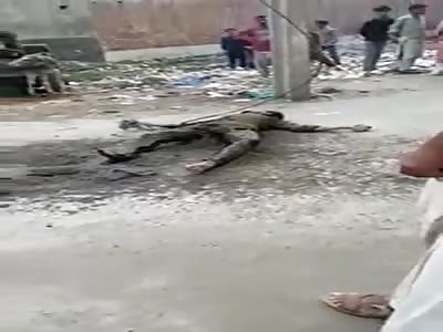 electric shock causes death