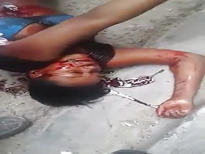 AGONY: Domestic Dispute Leaves Woman Stabbed on Street in Brazil