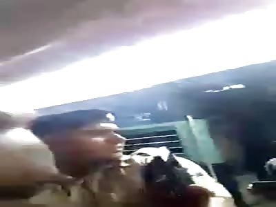 Accident, man loses his legs by train