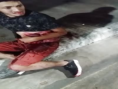 Man with Guts Spilled Out of Abdomen after Horrific Accident