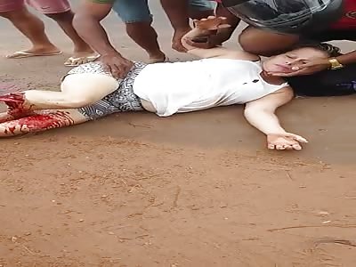 Lady with Leg Injured in Traffic Accident Is Attended by Witnesses