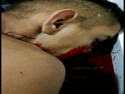 Gasping Blood Gurgling Moments After Shot in The Head