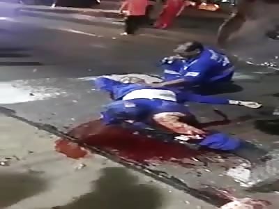 BRUTAL ACCIDENT LEAVES MAN WITH LEGS DESTROYED