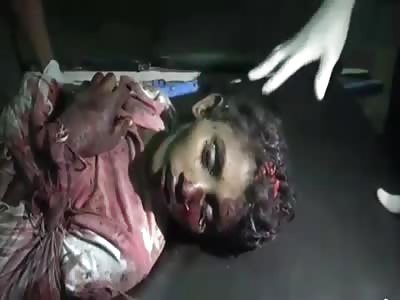 21 people were killed and 9 were injured in an inconclusive result 24-