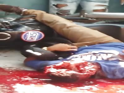 High Caliber Round Leaves Mans Face Wide Open