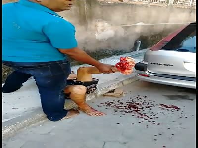 Suffering from pain after accident