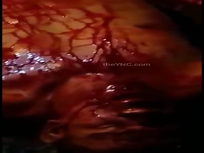 They lynched him and he suffers from pain