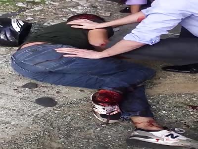 BRUTAL ACCIDENT LEAVES MAN WITH LEGS DESTROYED