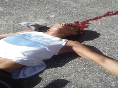 Man Paralyzed by Shot in the Head Slowly Dies in Agony 