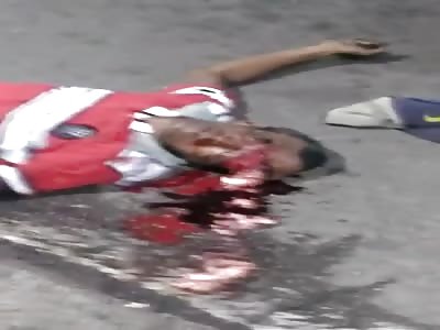 Man with his head plastered by bus