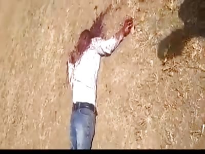 man with a shattered head