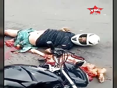 Motorcyclist with leg shattered after accident