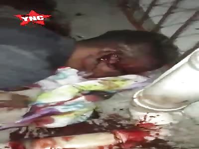 Dude Shot in the Brain... Takes his Last Dramatic Last Breathe 