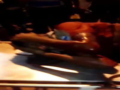 Thief in Hands of Medics Still Beaten Hard