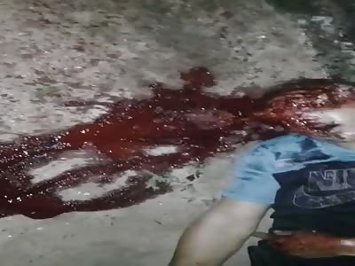 Teenager's Face Crushed and Disfigured from Brutal Headshots