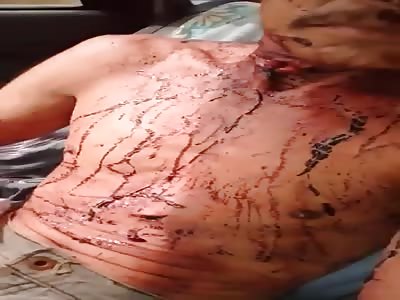 Wtf.Man suffer Machete attacked
