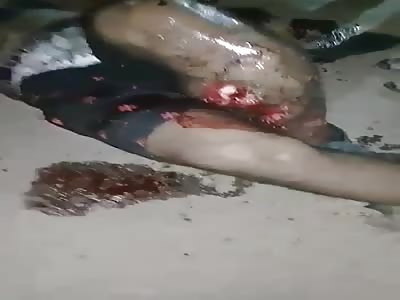 And THIS Might be the Most Fucked Up Leg I've Ever Seen