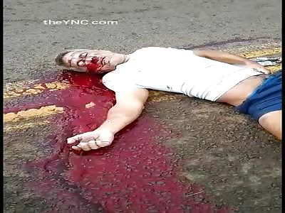 Pedestrian Fatally Run Over By a Garbage Truck 