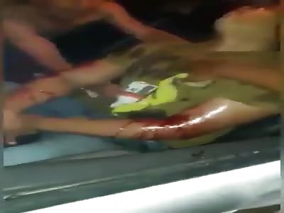 Man Performs Agonal Breathing After Armed Attack Inside his Car