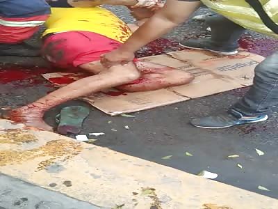 Shocking man with leg shattered after accident