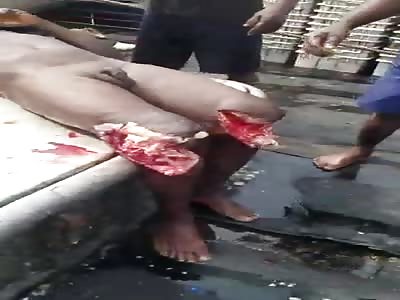 Horrific Shark Attack Leaves a Man with his Knees Chewed Off