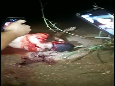 Man with Deep Gashes All Over Body from Rival Gang Attack.