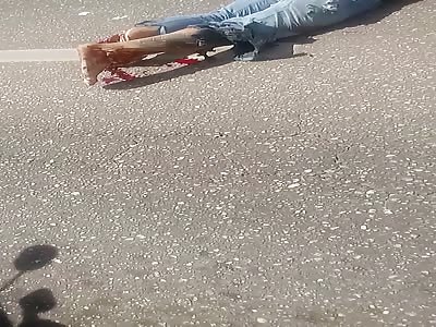 brutal accident leaves man with leg shattered