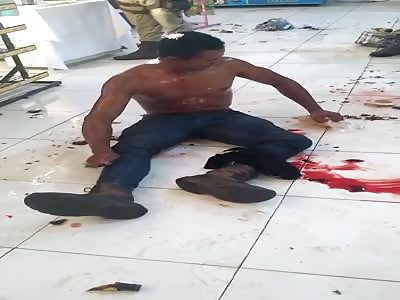 Crazy Dude Dips Potato Chips in His Blood