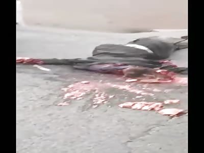 man with a crushed head