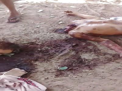 Losing His Head to a Machete...