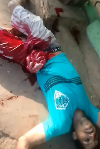 Stab Victim Holds His Guts.