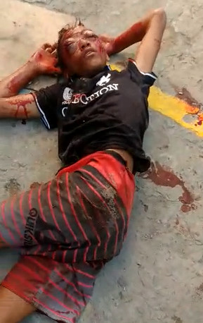 Epic Karma and Head Deformed by Multiple Kicked