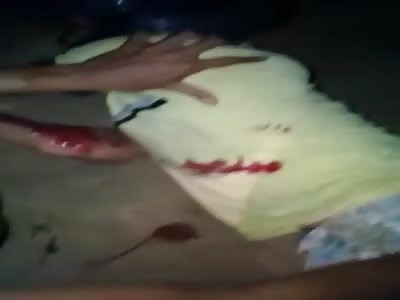 brutal , drunk man have leg cut in accident