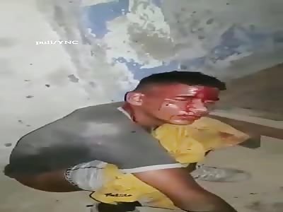 Rapist of 6 YO Forced to Sit on Bottle in Prison