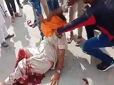 grandfather!! with a broken leg after an accident