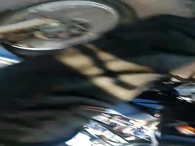 man with broken leg after accident