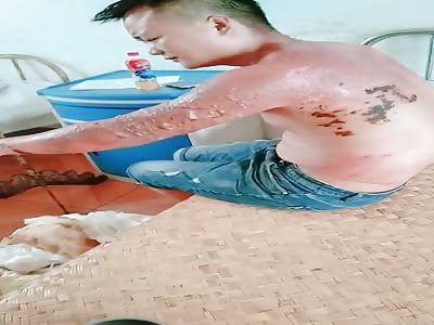 wtf man with strong arm burns