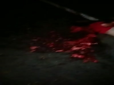 brutal accident .. man with crushed head