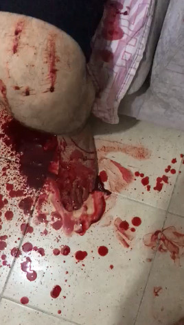 Moments After a Machete Attack