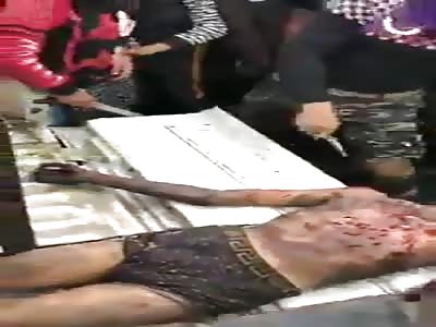 Mistahl Haig, his body was massacred