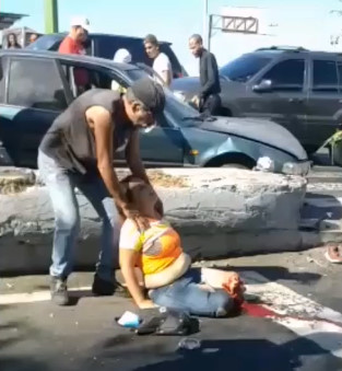 Woman With Limbs Missing Suffers Fully Awake