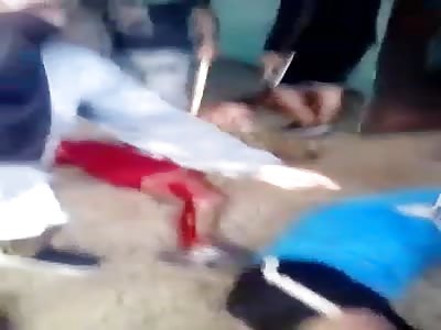 In agony after being shot by the police arg.