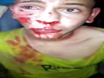 thief punished Brazil