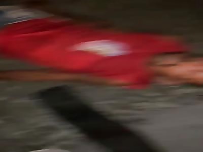 Man with shattered leg after accident