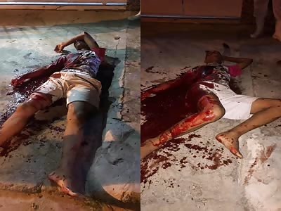 Street Thieves Hurt by Citizens Street Justice