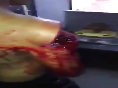 Man with deep cuts on body from machete 