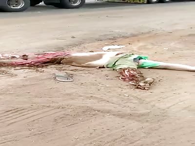 Shocking accident inrecognizable body 