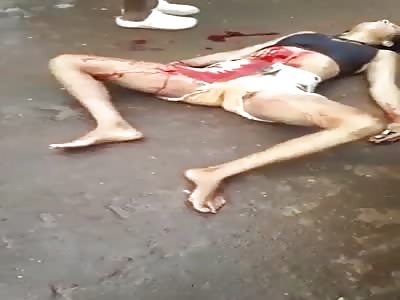 Woman in Agony Spread Eagle After Accident 